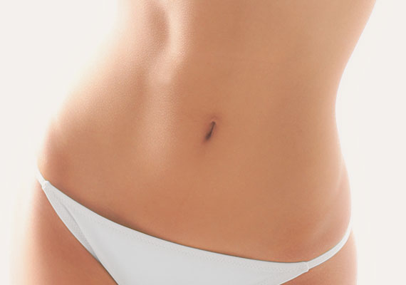 Abdominoplasty abdominoplastia-1