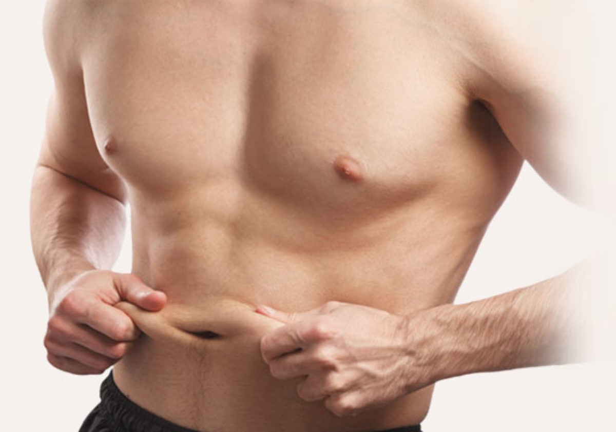 Cirugía estética de abdomen: ¿En qué consiste una abdominoplastia?