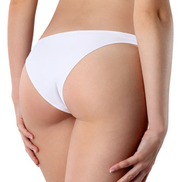 Gluteal augmentation aumento-gluteos-3