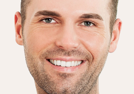 Otoplastia, cirugía de orejas en hombres cirugia-orejas-masculina