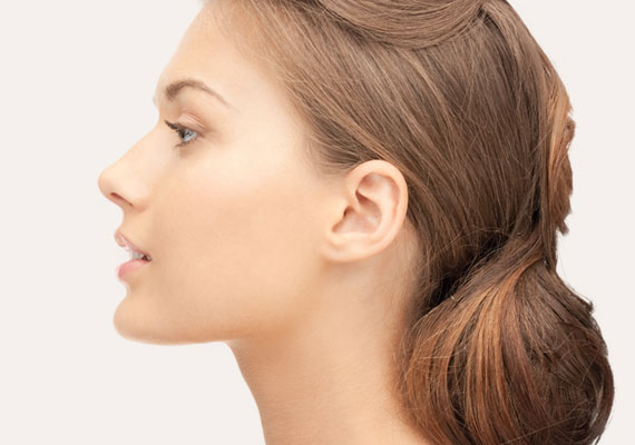 Operación de nariz: Rinoplastia ultrasónica rinoplastia-1