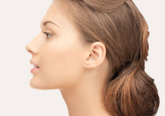 Rhinoplasty rinoplastia-1