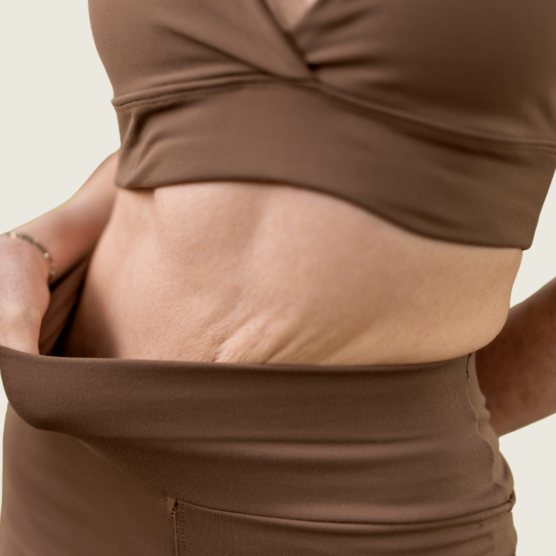 Mommy Makeover en Alicante | Recupera tu figura tras el embarazo explantacion-perez-de-la-romana-1