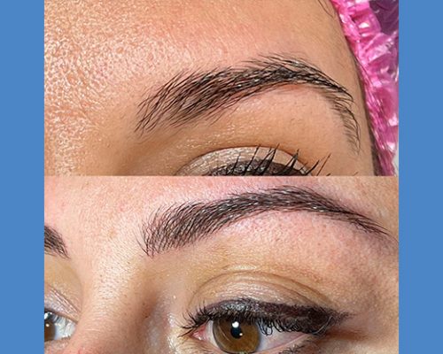 Brows Microblading and Eyelashes Extension in Alicante antes-despues-microblanding-4-3-pa764ucg8kmzdccs1zphz7hu9tfc5wkn1w8htjgo0w