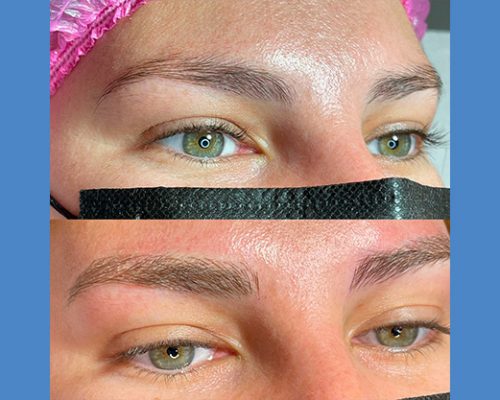 Brows Microblading and Eyelashes Extension in Alicante antes-despues-microblanding-5-2-pa765f0wexfagriqp8nai29zcalev8uqgql6dmm080