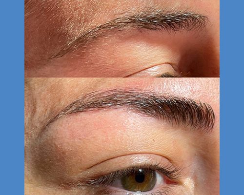 Microblading de Cejas y Extensión de Pestañas en Alicante antes-despues-microblanding-6-2-pa765nhg4fqvd96gbuaxmi54orfpsisbhwgjp49go0