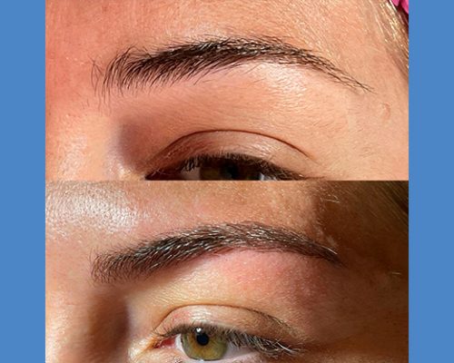 Brows Microblading and Eyelashes Extension in Alicante antes-despues-microblanding-6-3-pa765pd4i3tg0h3q0v46rho1vj6g7wzs65rino6obk