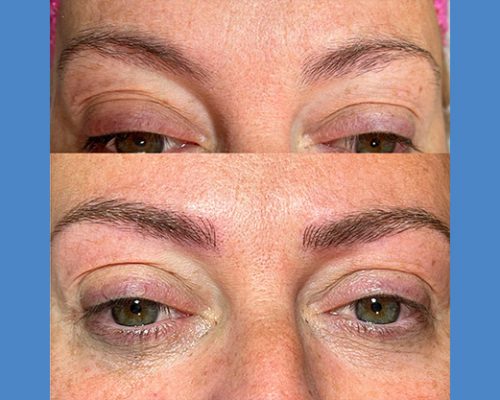 Brows Microblading and Eyelashes Extension in Alicante antes-despues-microblanding-7-1-pa765t4h9fylawy9ewqp1gpw92nx2pepiodgks13mo