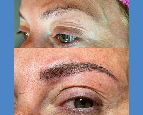 Brows Microblading and Eyelashes Extension in Alicante antes-despues-microblanding-7-2-pa765v05n415y4vj3xjy6g8tfueni3m66xofjbyba8