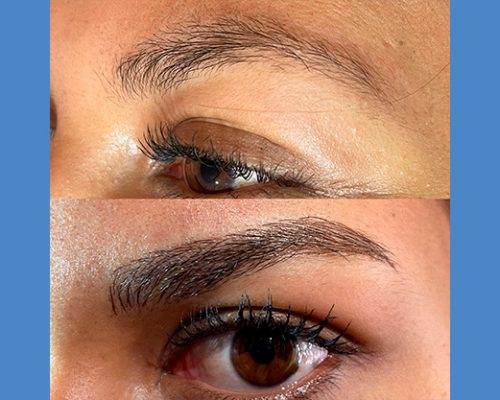 Brows Microblading and Eyelashes Extension in Alicante antes-despues-microblanding-8-2-pa7665cdqafbhugifk0ufvmvz2zourr7wcurtdizds